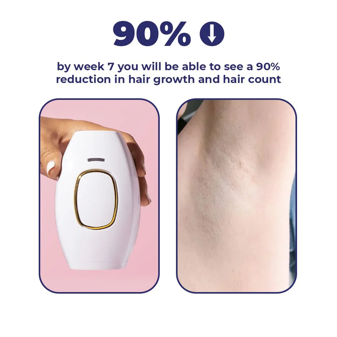 Portable IPL Hair Remover